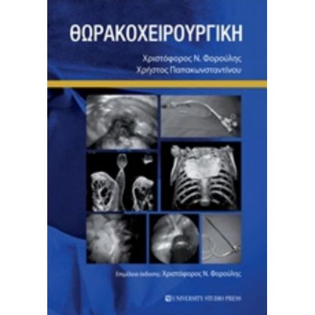 Θωρακοχειρουργική - Χριστόφορος Φορούλης