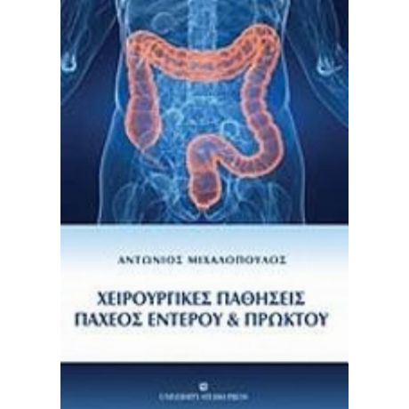 Χειρουργικές Παθήσεις Παχέος Εντέρου Και Πρωκτού - Αντώνιος Μιχαλόπουλος
